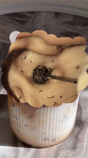 Satisfying Earwax Removal Video