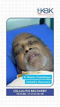 Cellulitis Recovery at KBK Hospitals | Patient Testimonial | Success Story