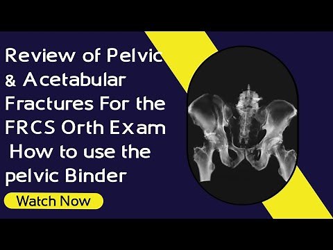 Review of Pelvic & Acetabular Fractures For the FRCS Orth Exam | How to use the pelvic Binder