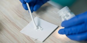 Zinc oxide eugenol cement | Dental Education Hub