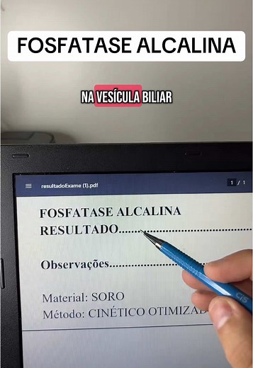 Exame de Fosfatase Alcalina: Entenda o Resultado