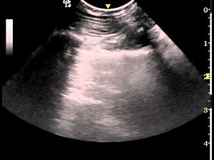 ultrasonographic glide sign from a normal dog