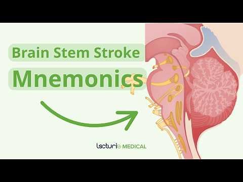 How to Ace Brain Stem Stroke Questions 💡 | USMLE Prep