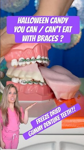 CANDY YOU CAN’T EAT WITH BRACES ?! Orthodontist Reacts GUMMY DENTURE TEETH?! #braces #candy #crunchy