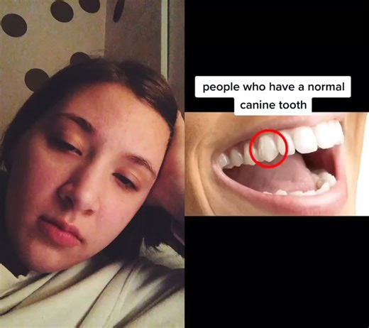 Sharp Canine Teeth: A Unique and Attractive Feature