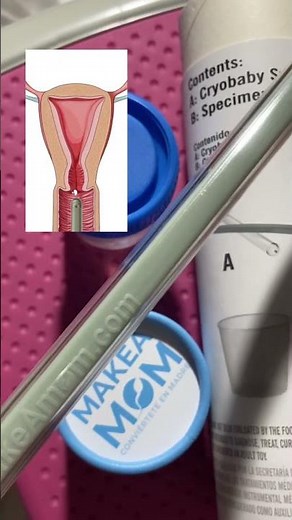 Ordered donor sperm for home insemination it got delivered in a tank