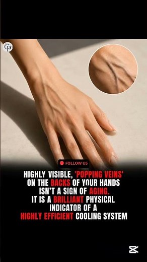 THE REAL REASON YOUR HAND VEINS"POP" OUT-IT'S NOT JUST ABOUT AGING!
