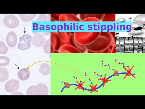 basophilic stippling