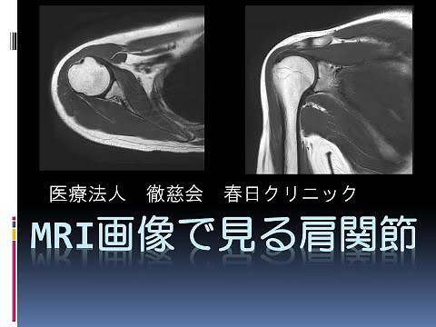 【春日クリニック】MRI画像で見る肩関節
