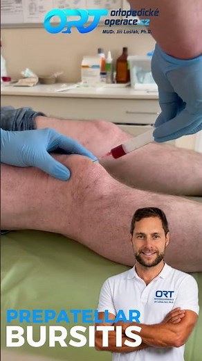 Blood-Filled Knee Swelling? Watch This Prepatellar Bursa Aspiration! 🩸🦵