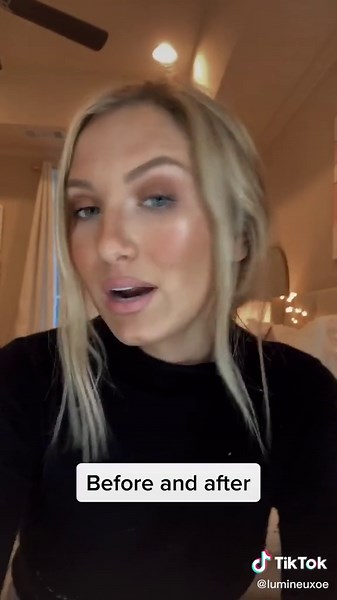 Lumineux Teeth Whitening Before and After Results