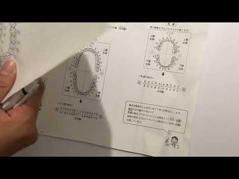 歯式の取り方