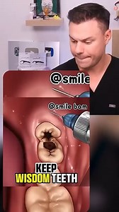 Is Removing Your Wisdom Teeth BAD For You?! 😭🦷 | TheBentistofficial