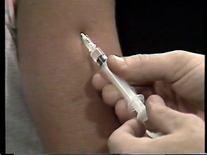 SubCutaneous Injections