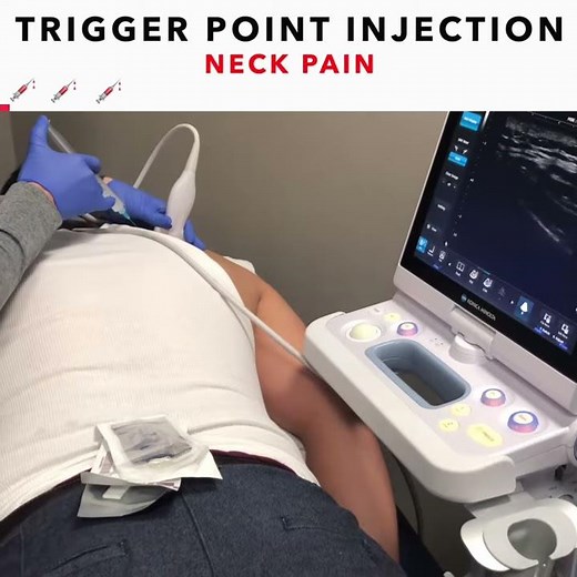 Trigger Point Injections For Neck and Shoulder Pain (2018)