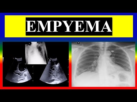 EMPYEMA - define , factors , pathophysiology , clinical , diagnostic , management