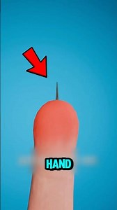 Never Pull Out a Splinter Again — This Trick Removes It Instantly!