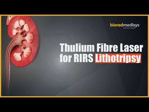 Advances in Kidney Stone Management: Thulium Fibre Laser for RIRS Lithotripsy | Biorad Medisys
