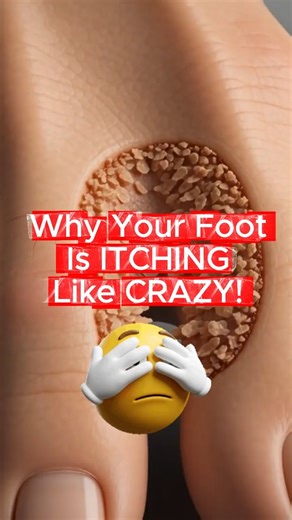 Why Your Foot Is Itching Like Crazy (Athlete’s Foot Explained)