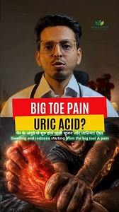 Uric Acid Symptoms in Legs & Joints? | Gout Pain Relief Ayurvedic Remedy | High Uric Acid Treatment