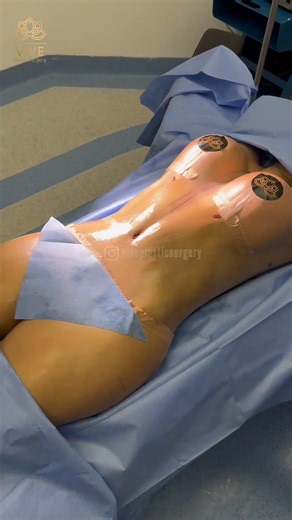 Becoming Her Best Version💖Mommy Makeover at Vive Plastic Surgery #tijuana 🤩