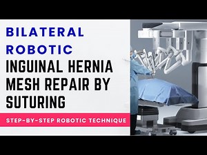 Bilateral Robotic Inguinal Hernia Mesh Repair by Suturing | Step-by-Step Robotic TAPP Technique