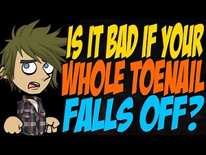 Is it Bad if Your Whole Toenail Falls Off?