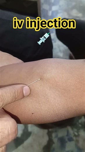 🏥💉𝗶𝗻𝘁𝗿𝗮𝘃𝗲𝗻𝗼𝘂𝘀 𝗶𝗻𝗷𝗲𝗰𝘁𝗶𝗼𝗻 𝗶𝘃🩺🥼 #docter #medical #nursing #injection #hospital #shorts #viral