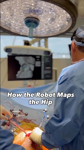 How Robotic Mapping Works in a Mako Hip Replacement