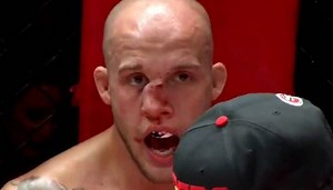 Blake Perry gets his broken nose smashed back into place by attending nurse (Video)