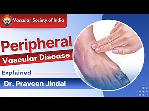 Peripheral Vascular Disease Explained by Dr. Parveen Jindal | Causes, Symptoms & Warning Signs