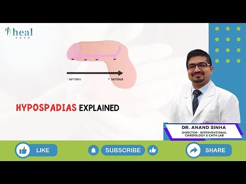 Hypospadias: A Comprehensive Overview by Dr Anand Sinha