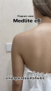 13 reactions | Medlite C6 Laser Program นวัตกรรมคืนความใสให้ผิว...