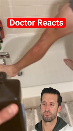 Hydrogen Peroxide vs Open Wound 😳 | Doctor ER