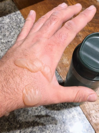 Café caliente y accidente con botella Stanley