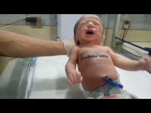 Head-to-Toe Assessment of a Newborn Baby | Complete Neonatal Physical Examination