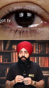 140K views · 5.3K reactions | "The Dangers of Sleeping with Your Eyes Open "#SleepHealth #EyeCare #SleepTips #HealthAwareness #wellnesscommunity | JoT Tv Australia | Facebook
