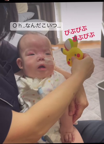 猫鳴き症候群を持つ赤ちゃんの日常