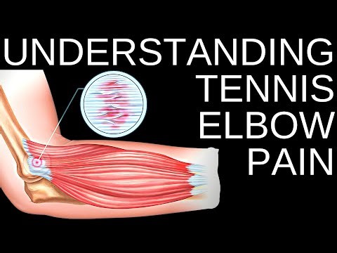 Best 3 Tennis Elbow Exercises For Elbow Pain Relief