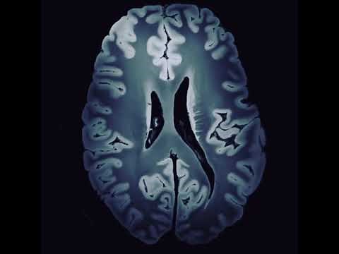 7 Tesla MRI - The Highest Resolution Image of the Brain in the World