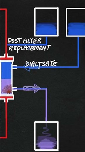 Continuous hemodiafiltration (CVVHDF)