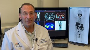 The FDA has approved the PSMA-targeted imaging agent, Pylarify, for men with prostate cancer. Hoag has been the only location in Orange County to offer this imaging agent, as part of an ongoing clinical trial. Learn more about this trial from Gary Ulaner, M.D., Ph.D., the James & Pamela Muzzy Endowed Chair of Molecular Imaging and Therapy. #HoagPride | Hoag | Facebook