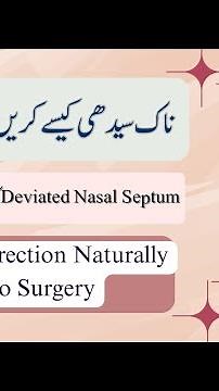 Deviated nasal septum treatment without surgery | DNS | Homeopathy