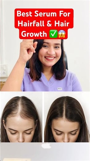 Best Serum For Hairfall & Hair Growth | #doctorrajni #skincare #haircare #hairgrowthserum #hairfall