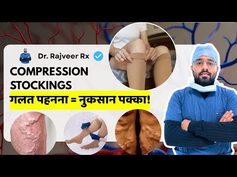 Are Compression Stockings Safe to Use? Hindi Guide for Varicose Veins | Dr Rajveer Rx