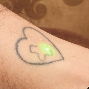 10M views · 6.7K reactions | Easy Tattoo Removal | Science, Tech and Universe | Facebook