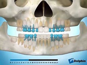 Eruption of teeth panoramic