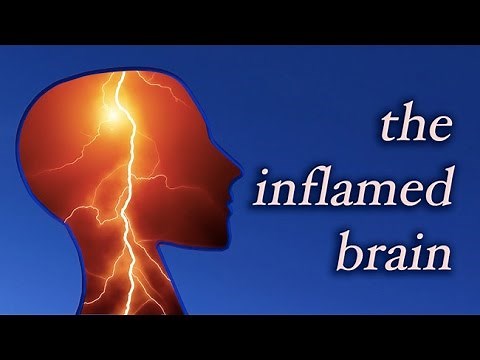 The Inflamed Brain