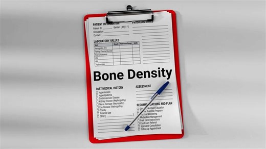Medical clipboard with patient clinical form showing bone density assessment and laboratory values. Healthcare documentation concept with physician notes and medical examination record.