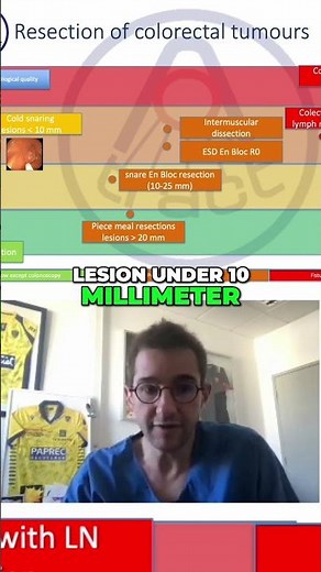 Snaring Techniques: Effective Endoscopic Lesion Removal #shorts